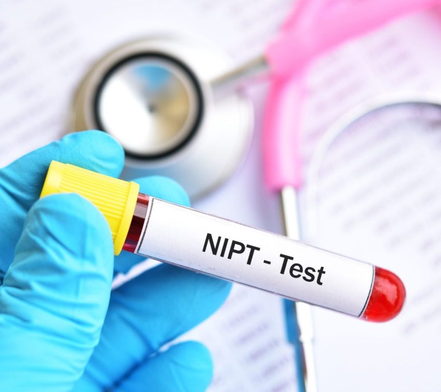 NIPT test swindon